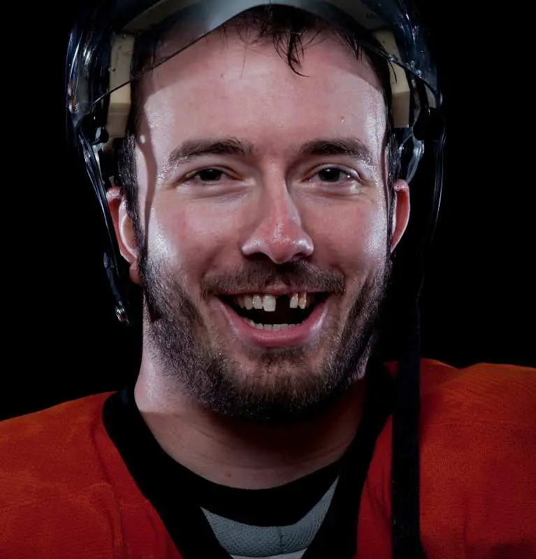 Why Do Hockey Players Lose Teeths